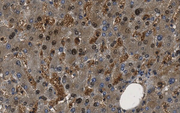 Anti-Glutathione S-transferase A5 (GSTA5)